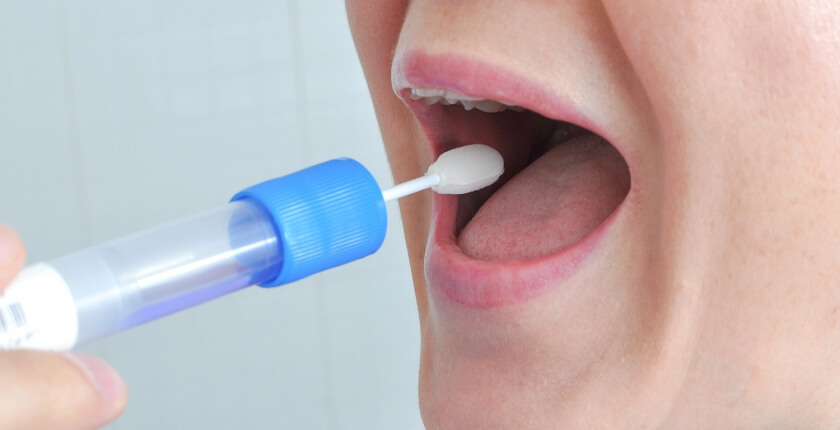 oral-fluid-saliva-drug-test-kits-cmm-technology-perth-wa